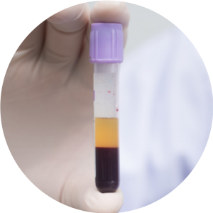 Separated plasma analyses