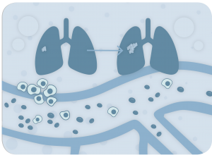 Illustration of metastatic cascade of cancer cells