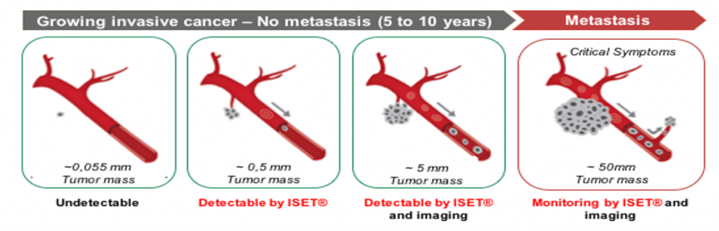 Stapes of growing invasive cancer